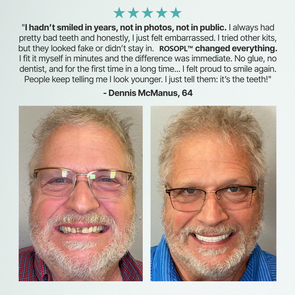 🔥🔥🔥Ends Today: 70% OFF!🦷OPAARI™ Custom-Fit Full Functional Dentures Make you more confident