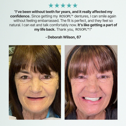 🔥🔥🔥Ends Today: 70% OFF!🦷OPAARI™ Custom-Fit Full Functional Dentures Make you more confident